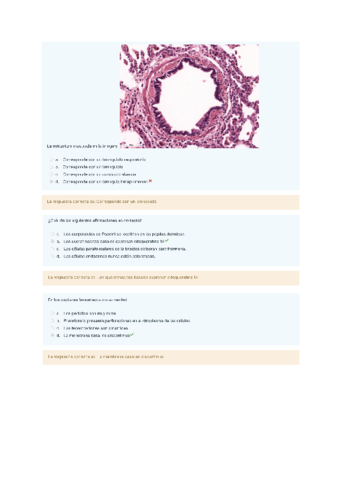 Primer Test Evaluacion Continua Pdf