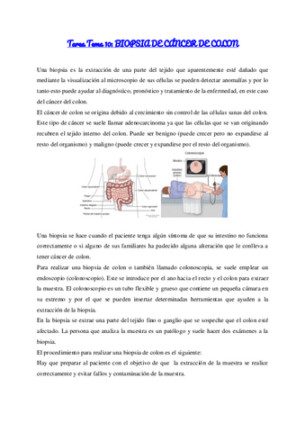 Tarea Tema Biopsia De Cancer De Colon Pdf