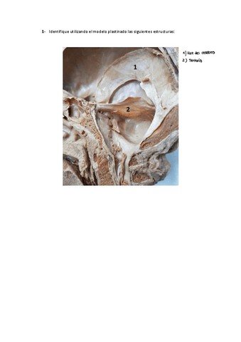 Taller Tronco Del Encefalo Y Cerebelo Pdf