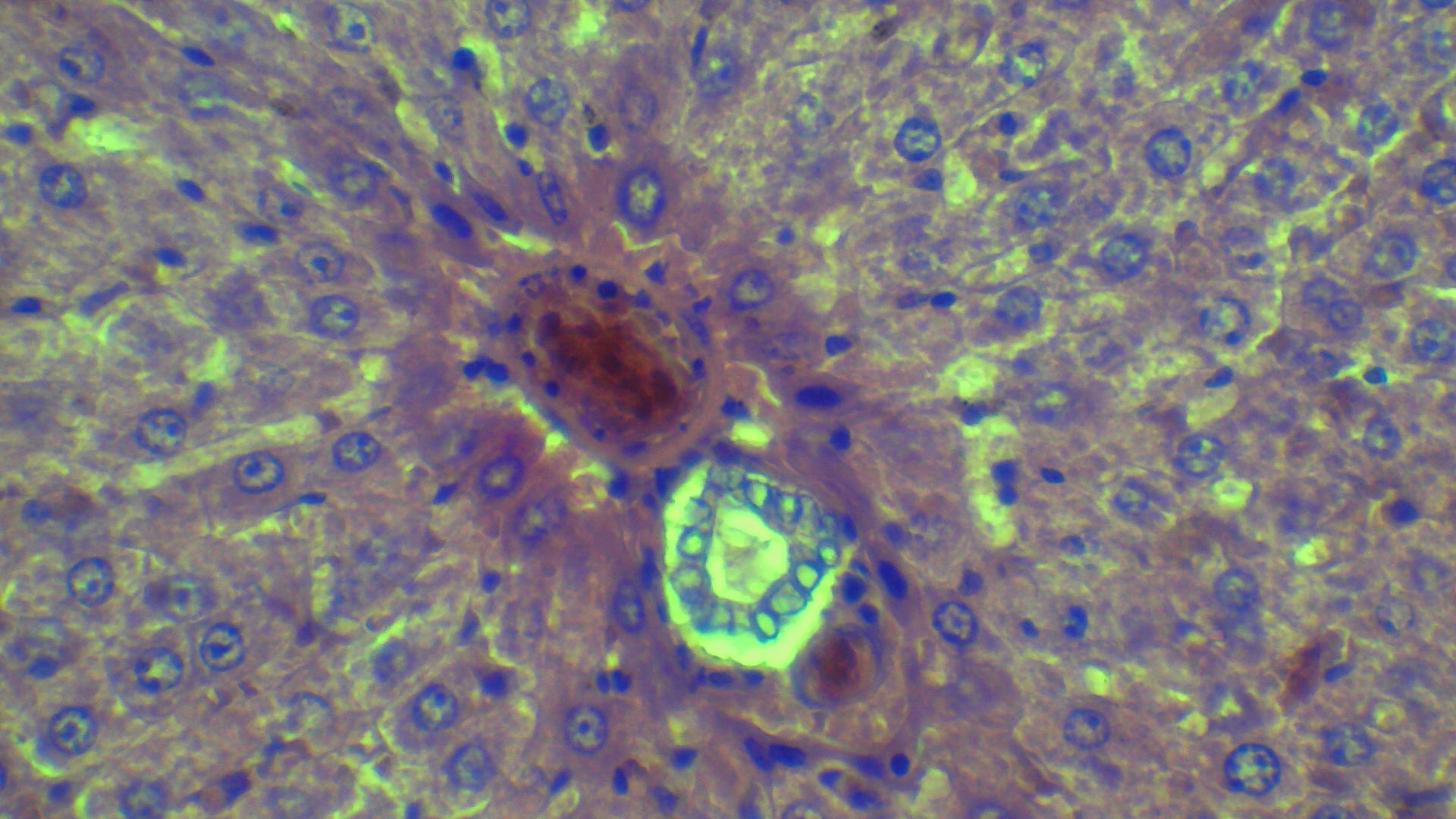 #Histologia
coloración hematoxilina eosina
Hígado