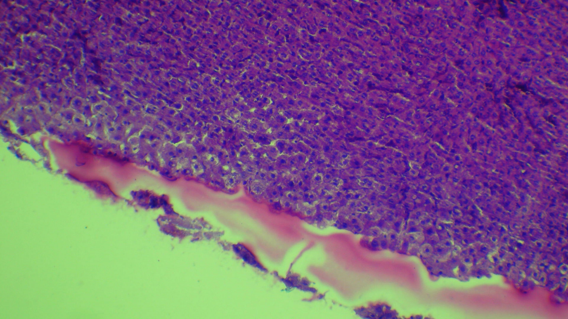 #HISTOLOGÍA #1°Grado
coloración hematoxilina eosina
Hígado