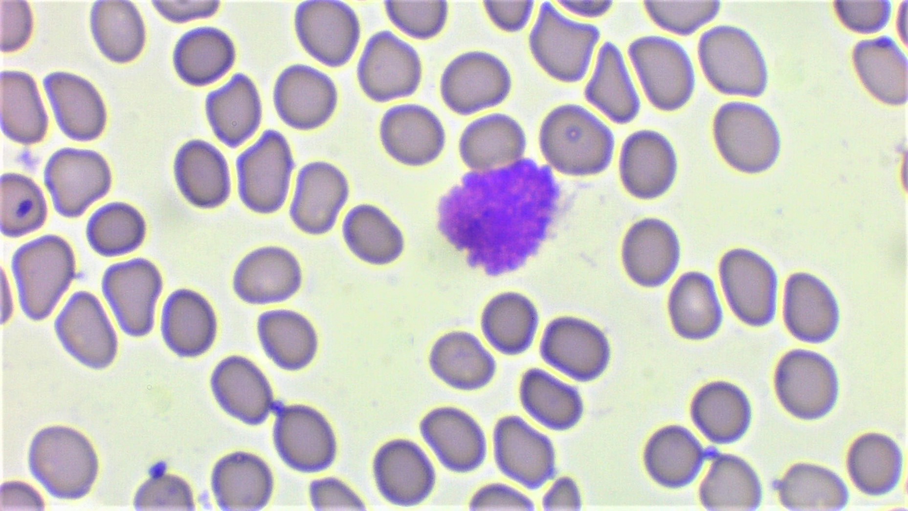 #HISTOLOGÍA
#1°GRADO
Identificación de células sanguíneas
Basófilo