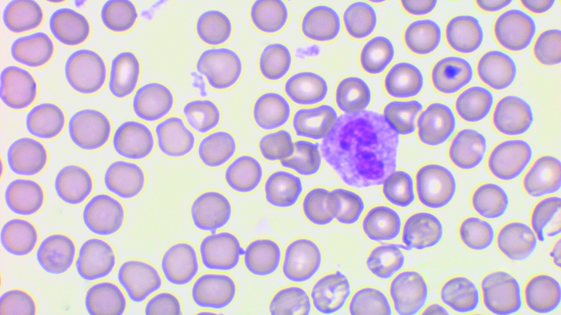 #HISTOLOGÍA
#1°GRADO
Identificación de células sanguíneas
Eosinófilo