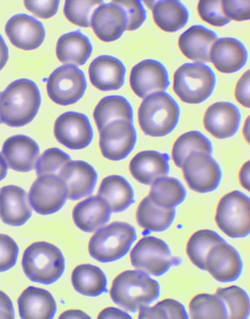 #HISTOLOGÍA
#1°GRADO
Identificación de células sanguíneas
Hematíes