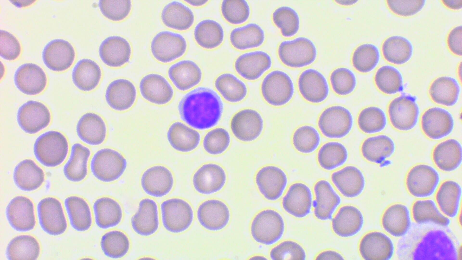 #HISTOLOGÍA
#1°GRADO
Identificación de células sanguíneas
Linfocito