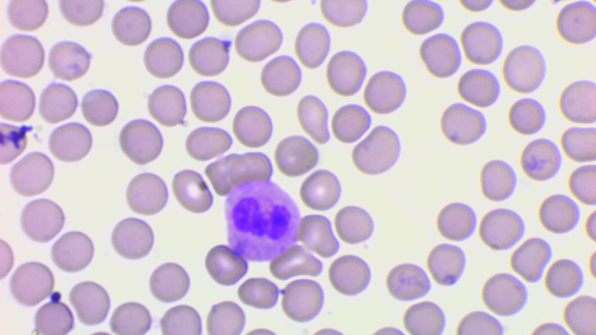 #HISTOLOGÍA
#1°GRADO
Identificación de células sanguíneas
Monocito