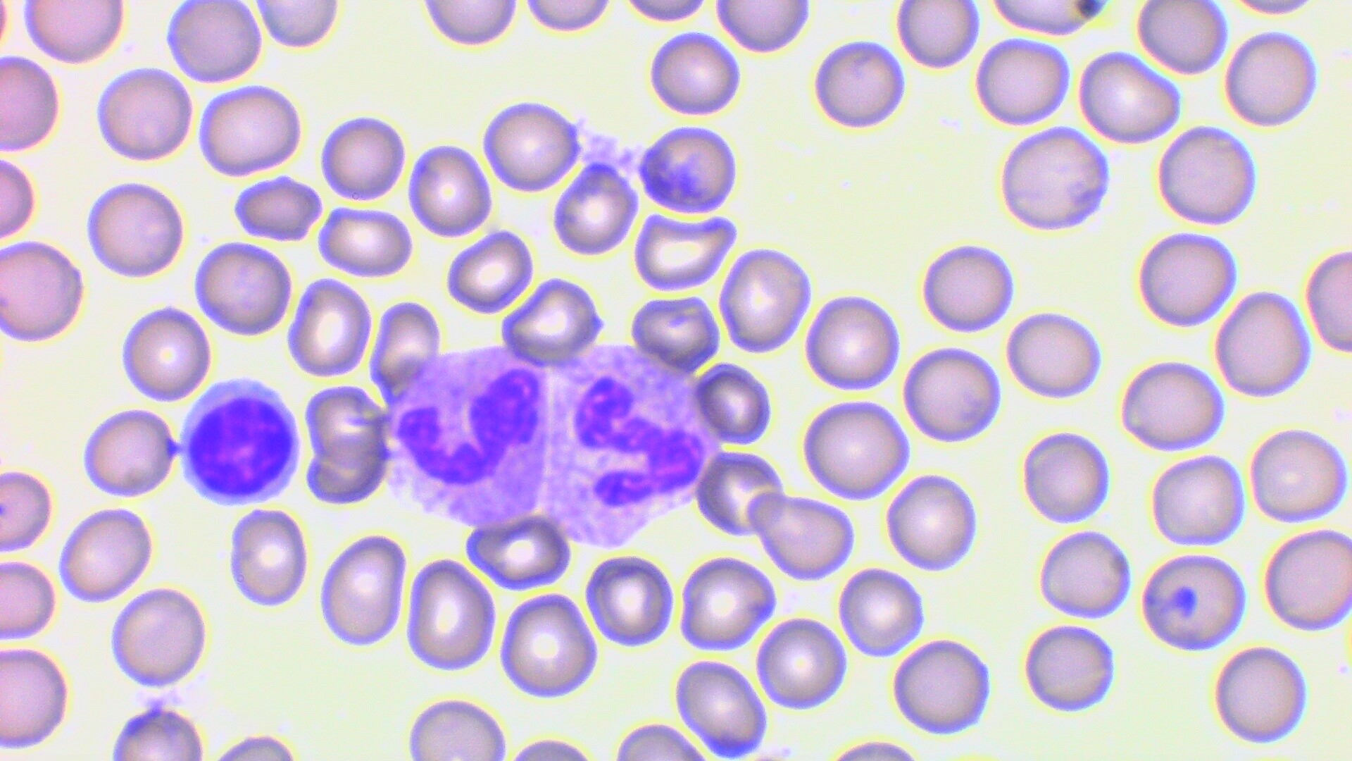 #HISTOLOGÍA
#1°GRADO
Identificación de células sanguíneas
Neutrófilo en cayado