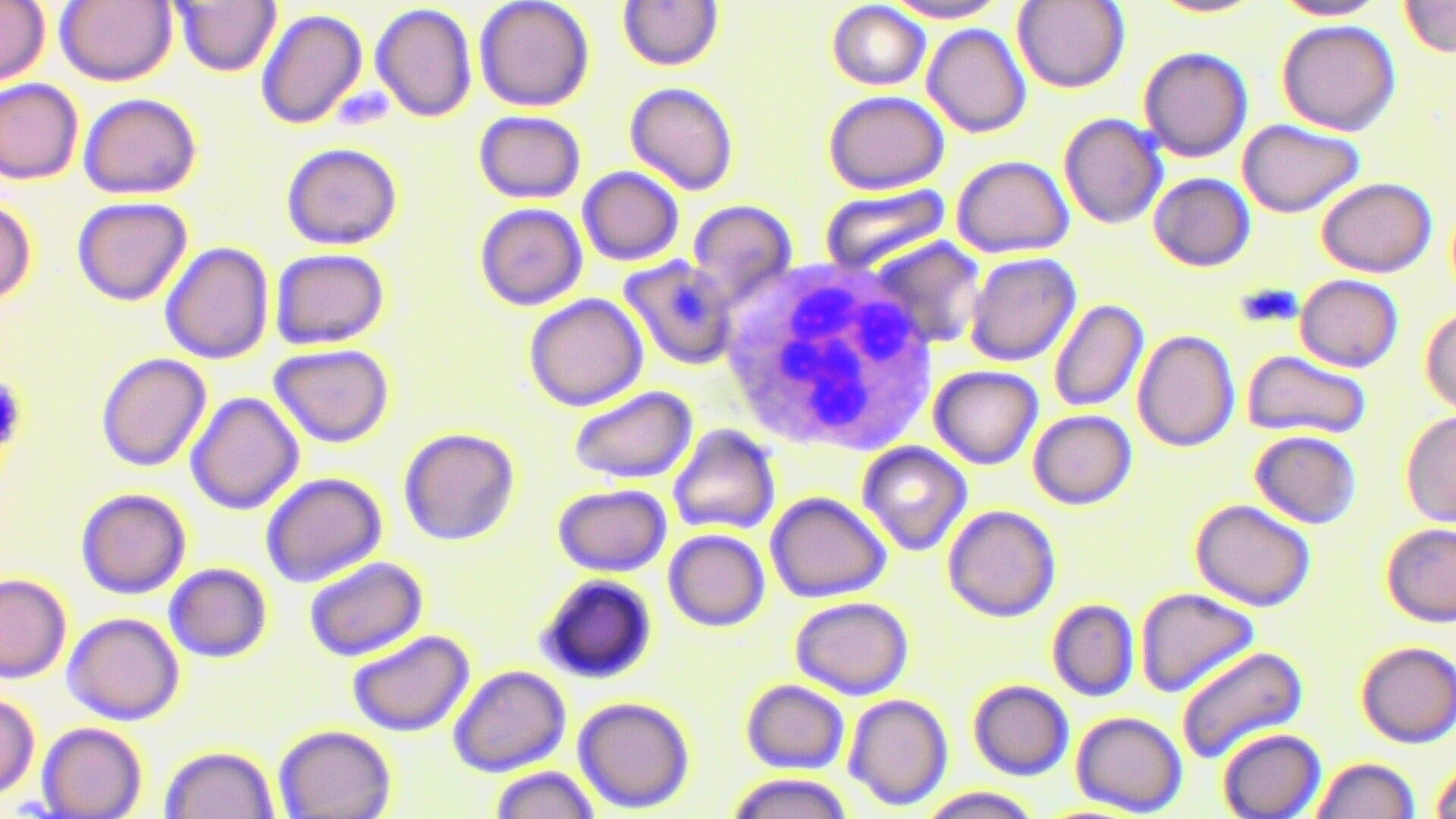 #HISTOLOGÍA
#1°GRADO
Identificación de células sanguíneas
Neutrófilo