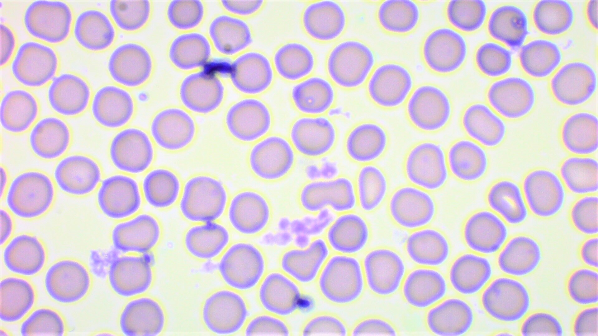#HISTOLOGÍA
#1°GRADO
Identificación de células sanguíneas
Plaquetas