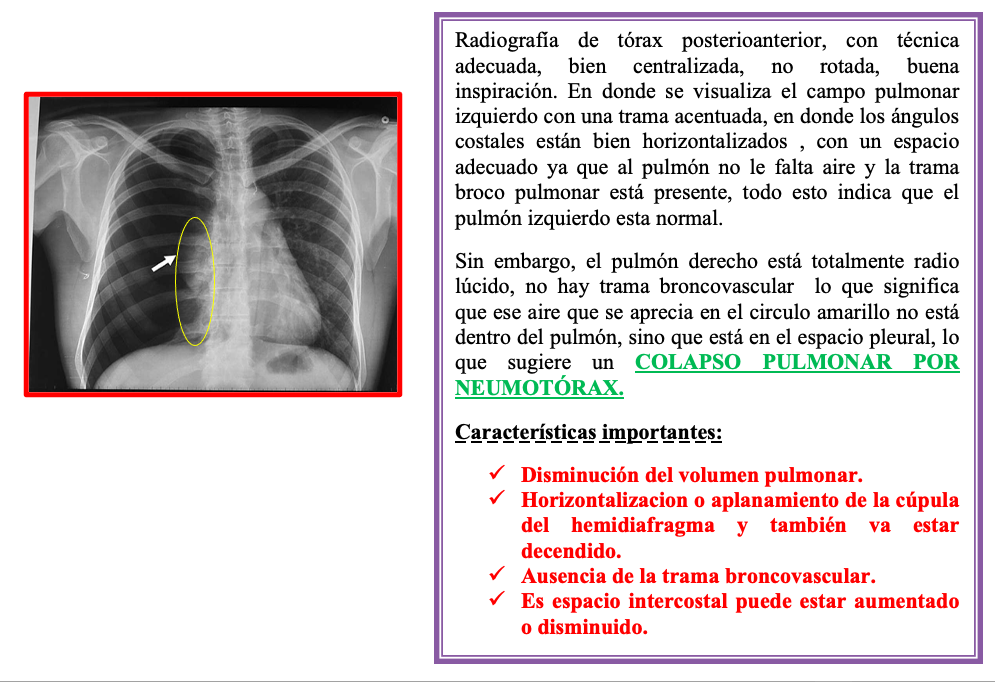 Tórax Patológico: Descripción y diagnostico de Imágenes.
