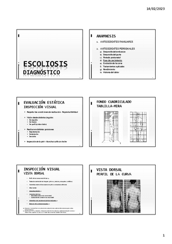 4.-ESCOLIOSIS-II.pdf
