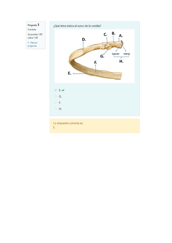Solucion-Minitest-Osteo-Artrologia-del-tronco.pdf