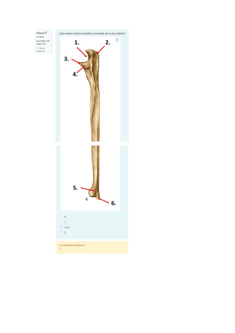Solucion-Minitest-Osteo-Artrologia-del-miembro-Superior.pdf