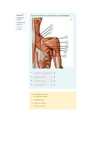 Solucion-Minitest-Musculos-de-la-cintura-escapular-y-del-brazo.pdf