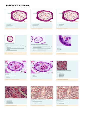 Cuestionario Práctica 3. Placenta.pdf