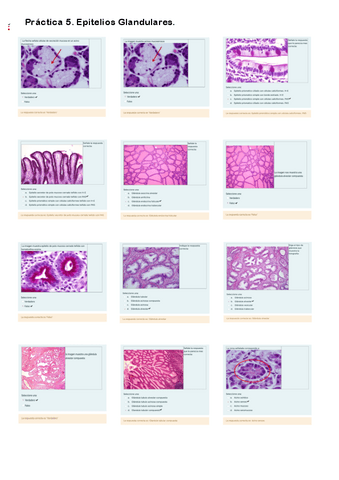 Cuestionario Práctica 5. Epitelios Glandulares.pdf