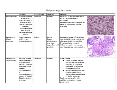 Canceres-pulmonares.pdf