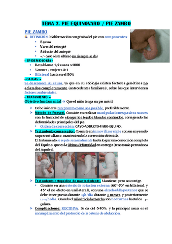 TEMA-7.-PIE-EQUINOVARO-PIE-ZAMBO.pdf
