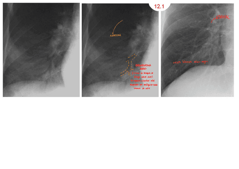 ANEXO-T12.pdf