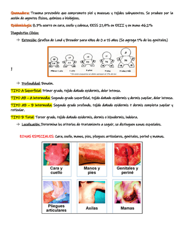 Quemadura..pdf