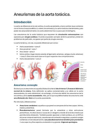ANEURISMA-DE-LA-AORTA-TORACICA.pdf