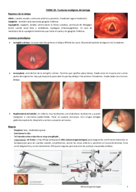 Tema 25.Carcinoma de laringe.pdf