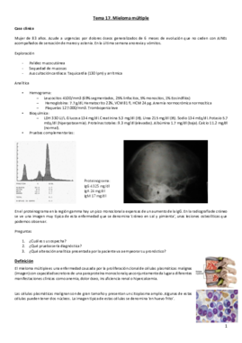 Tema 20. Mieloma múltiple.pdf
