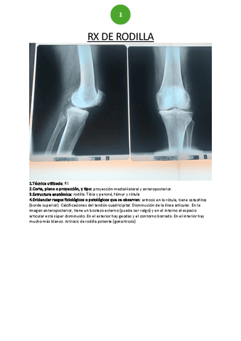 RX-rodilla.pdf