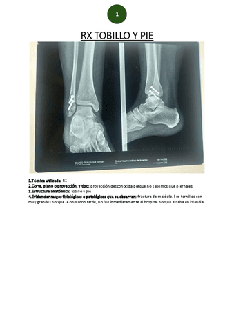 RX-tobillo-y-pie.pdf