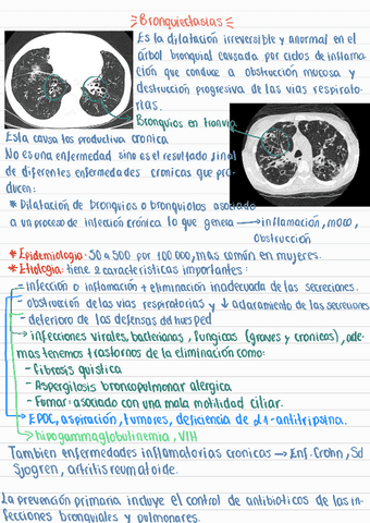 Bronquietasias240501173121.pdf