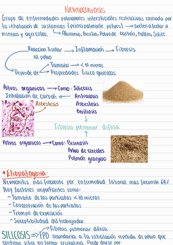 Neumoconiosis240504124947.pdf