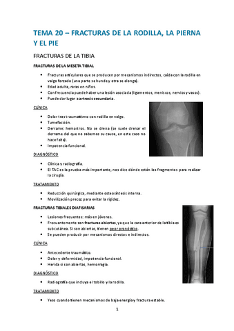 Tema-20.-Fracturas-de-la-rodilla-la-pierna-y-el-pie.pdf