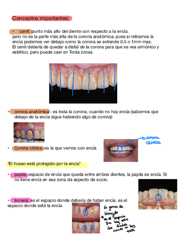 Anatomia-II-INCISIVO-CENTRAL-Y-LATERAL-SUPERIOR.pdf