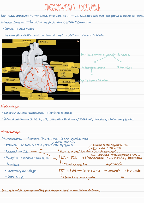 cardiomiopatia-isquemica240521130939.pdf