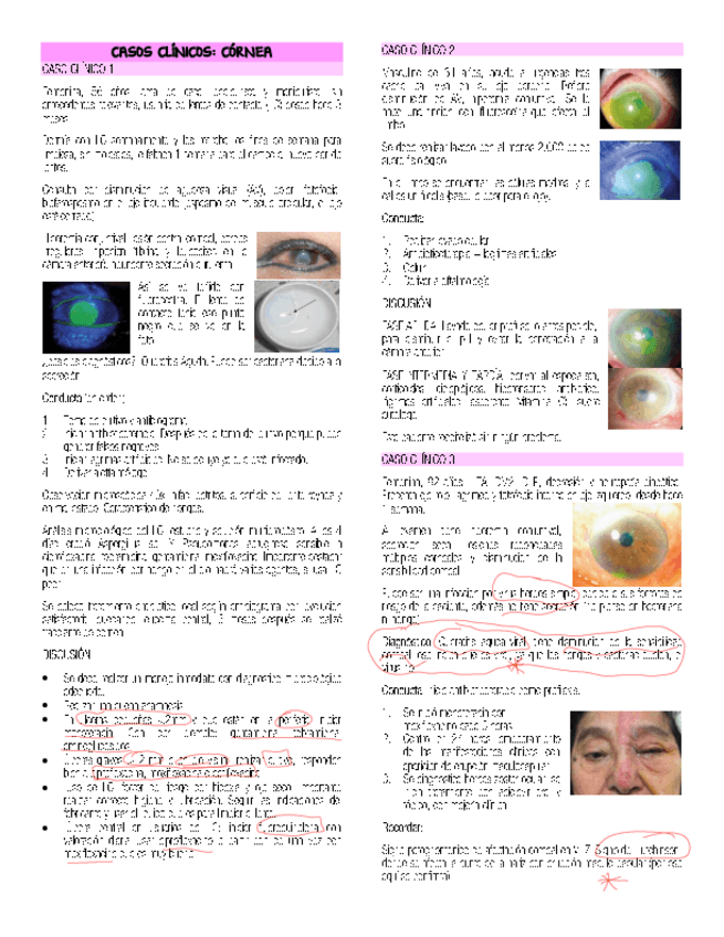 CORNEA-PARTE-2.pdf