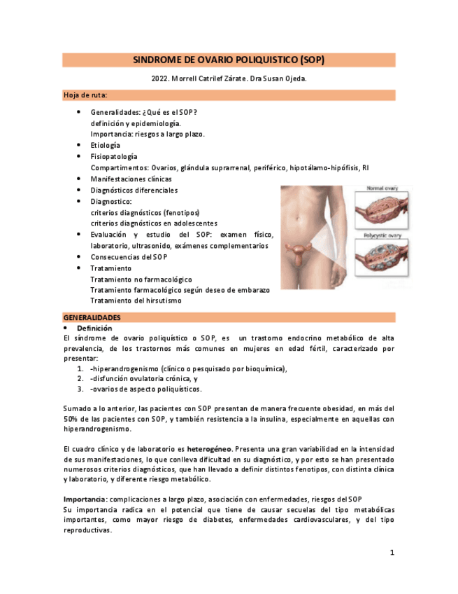 Sindrome-ovario-poliquistico.pdf