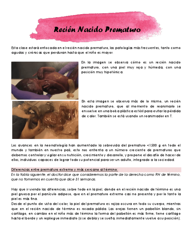 29.-RN-prematuro.pdf