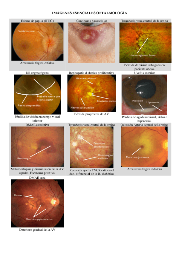 Imagenes-esenciales-oftalmo.pdf