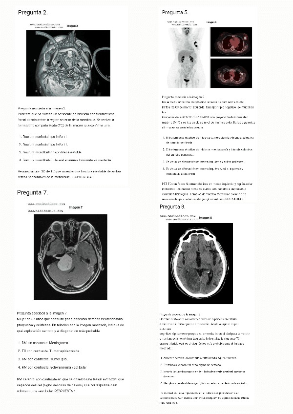 Preguntas-MIR-2024-Radiologia240614183826.pdf
