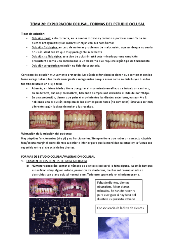 TEMA-26-Exploracion-oclusal-formas-del-estudio-oclusal.pdf