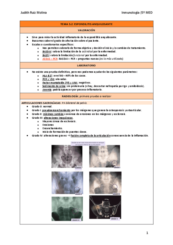 TEMA-3.2-ESPONDILITIS-ANQUILOSANTE.pdf