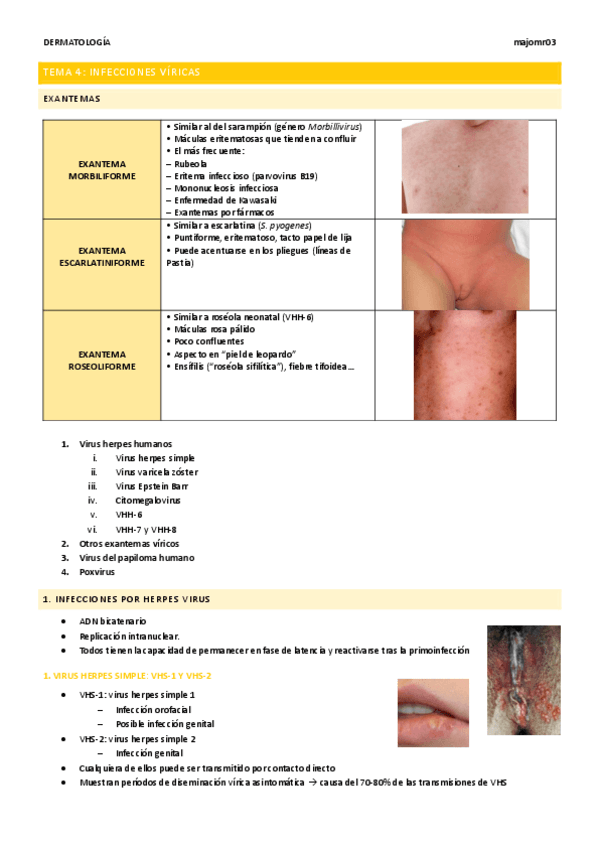 Tema-4-Infecciones-viricas.pdf