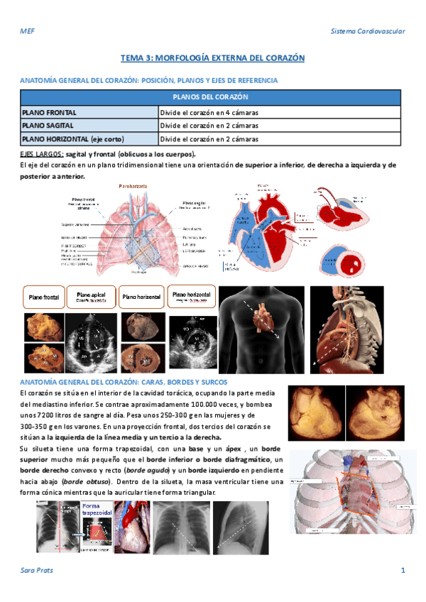 TEMA-3-MORFOLOGIA-EXTERNA-DEL-CORAZON.pdf