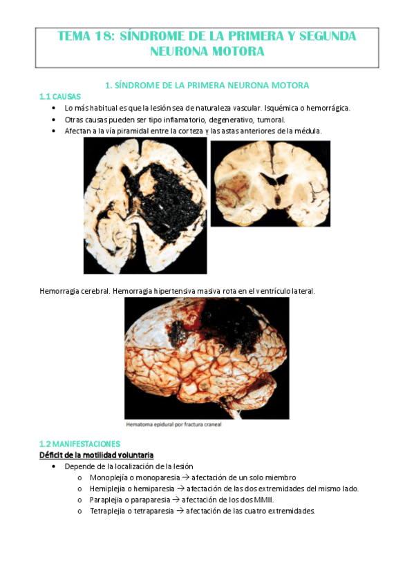 TEMA-18.pdf