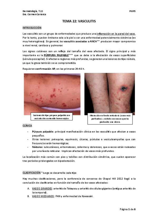 TEMA-22.-VASCULITIS.pdf