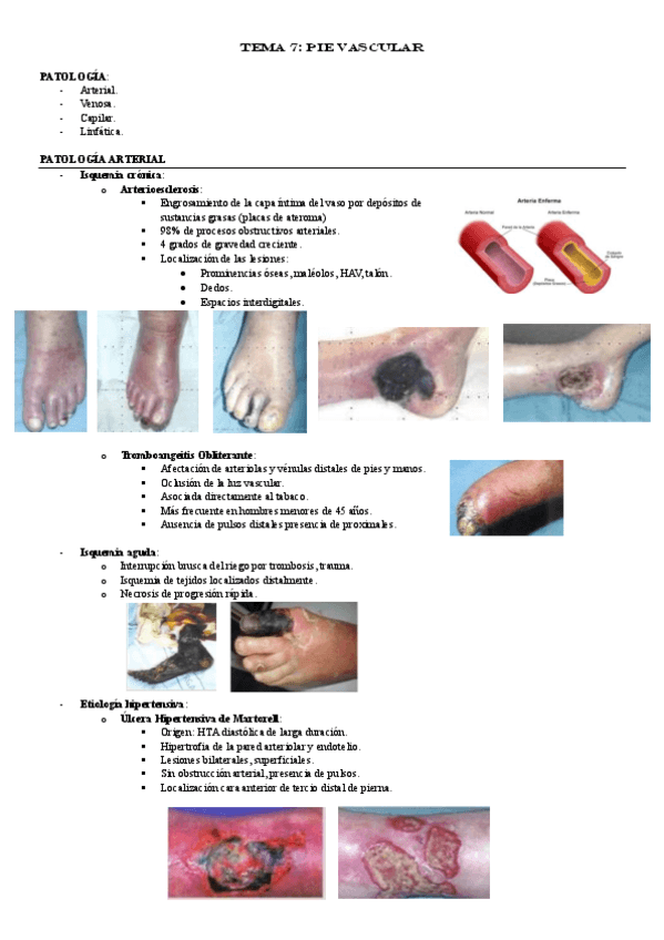 TEMA-7-PIE-VASCULAR.pdf