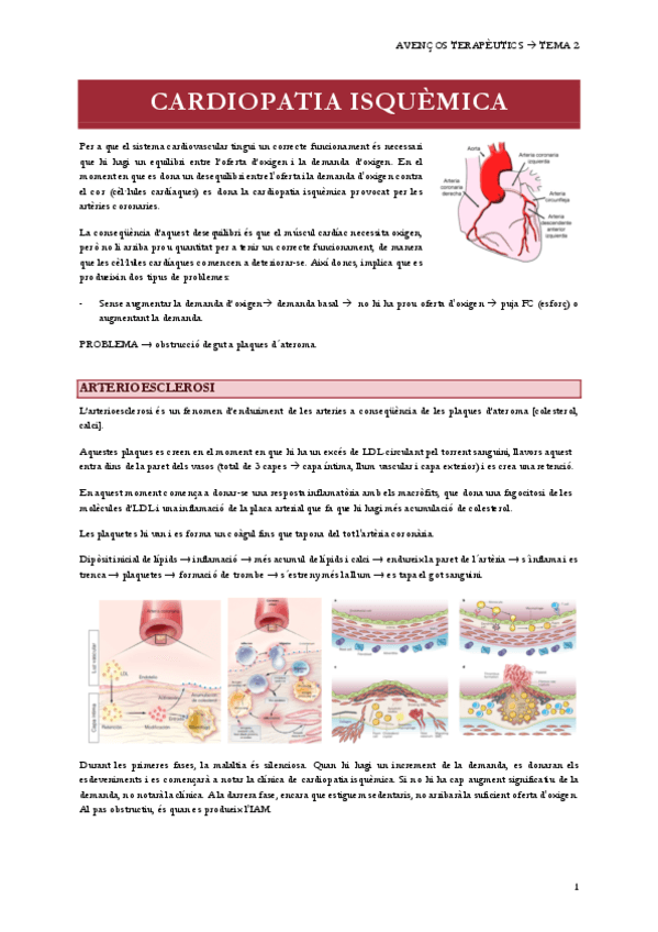 T2CARDIOPATIA-ISQUEMICA.pdf