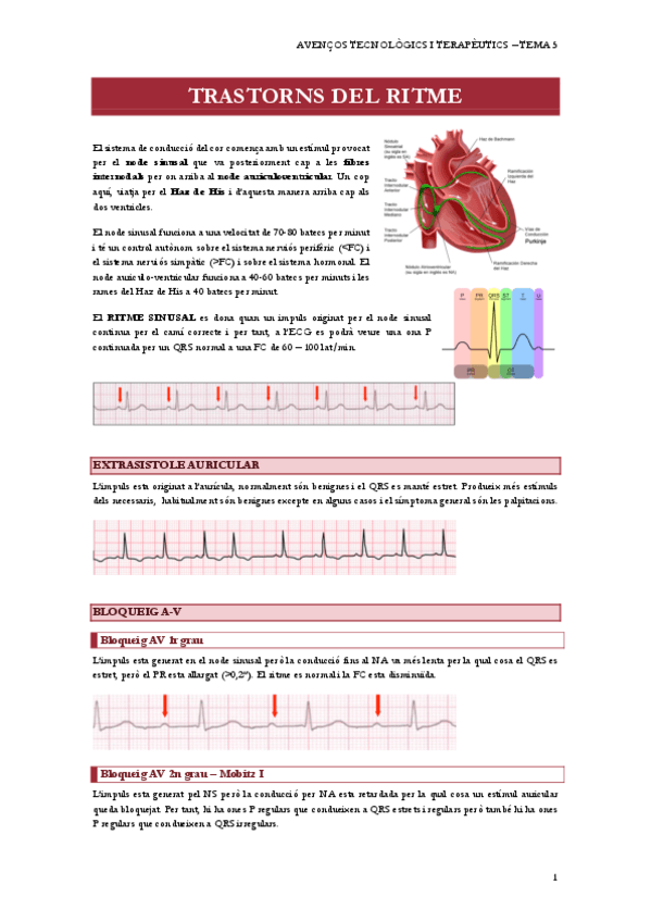 T5-TRASTORNS-DEL-RITME-WOULAH.pdf