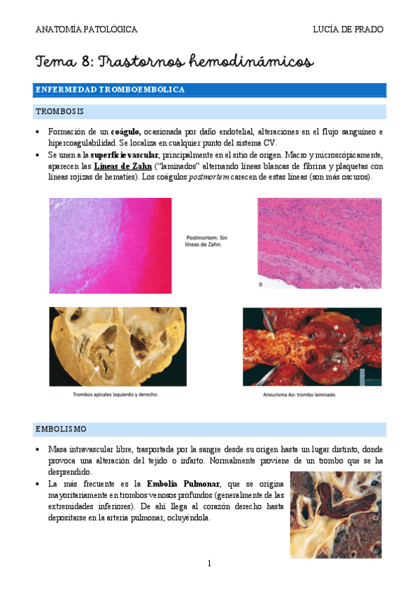 Trastornos-hemodinamicos-2425.pdf