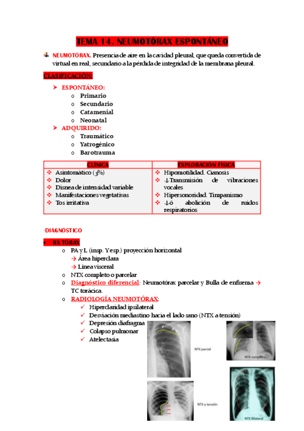 TEMA-14.-NEUMOTORAX-ESPONTANEO.pdf